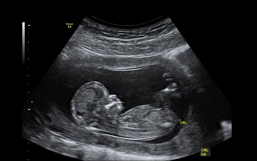 La bebé nació de un embrión congelado de hace 27 años